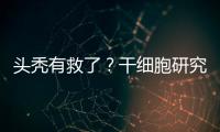 头秃有救了？干细胞研究阐明压力如何影响毛发生长